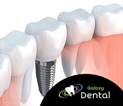 Galaxy Dental Galaxy Dental